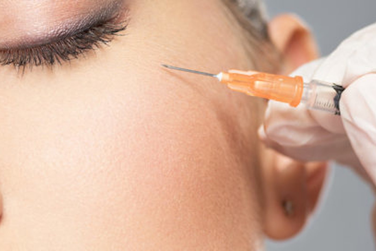 Hyaluronsäureunterspritzung - Ästhetische Medizin