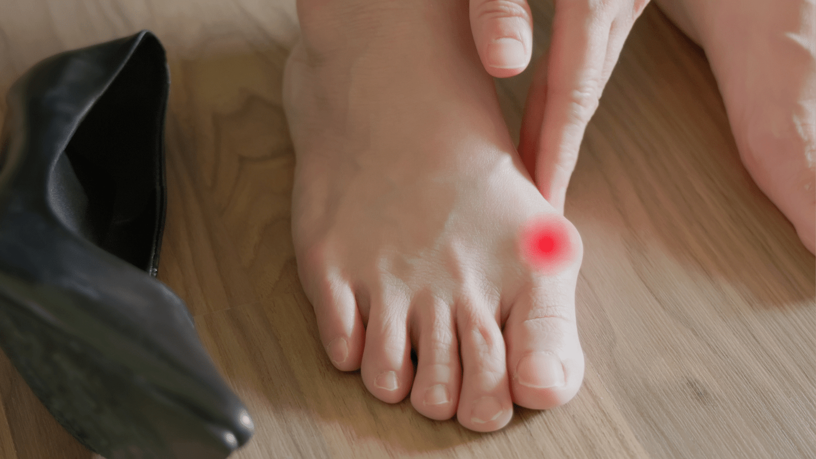 Hallux Valgus